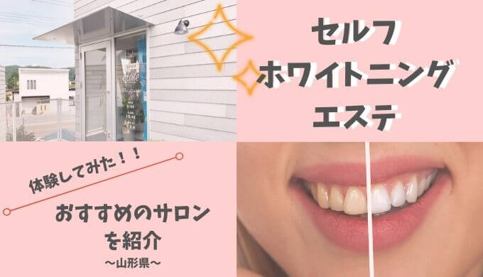 山形でセルフホワイトニングエステ！低価格・痛みなしで本来の白い歯に！長井市エトワール